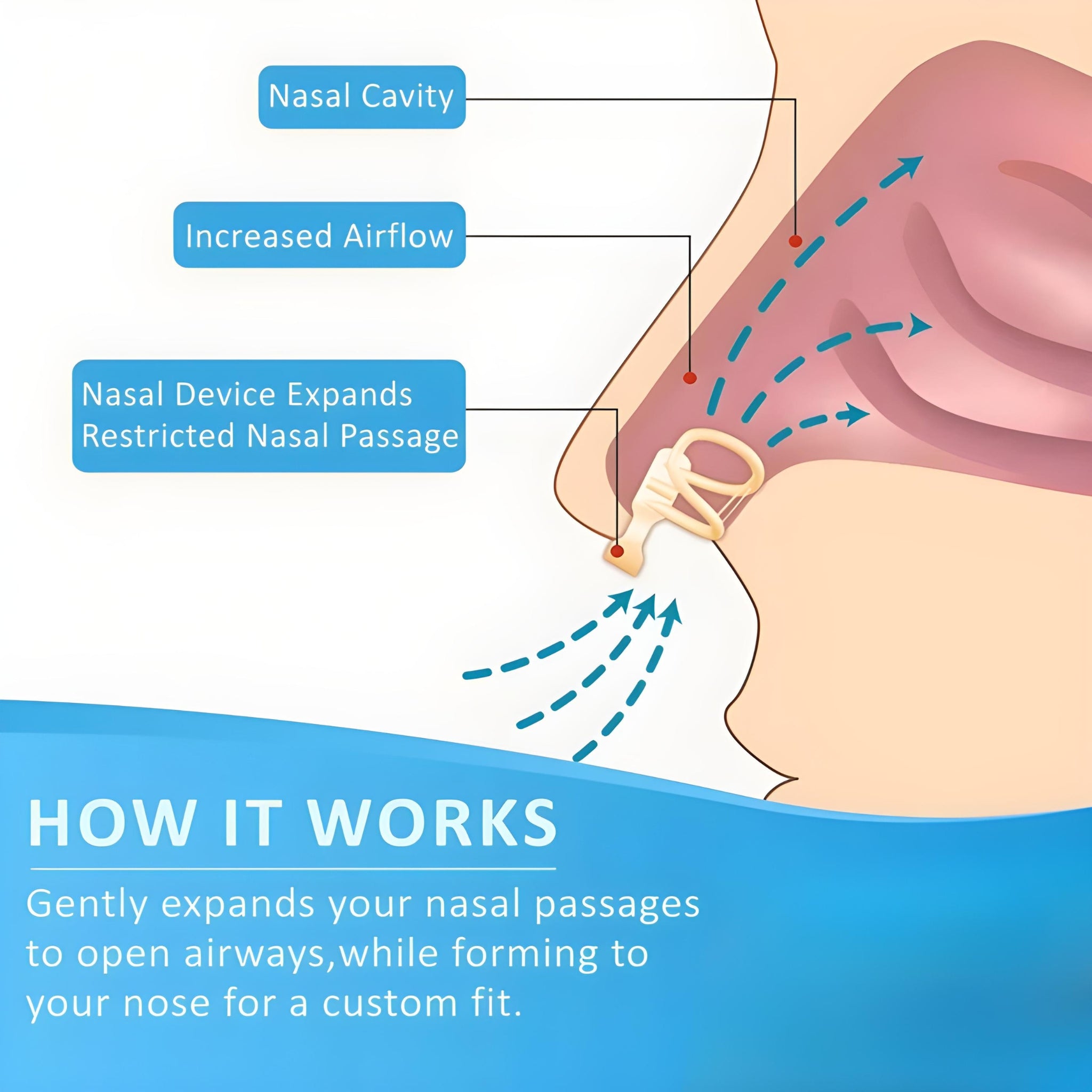 AirEase – Anti-Snoring Nasal Dilator