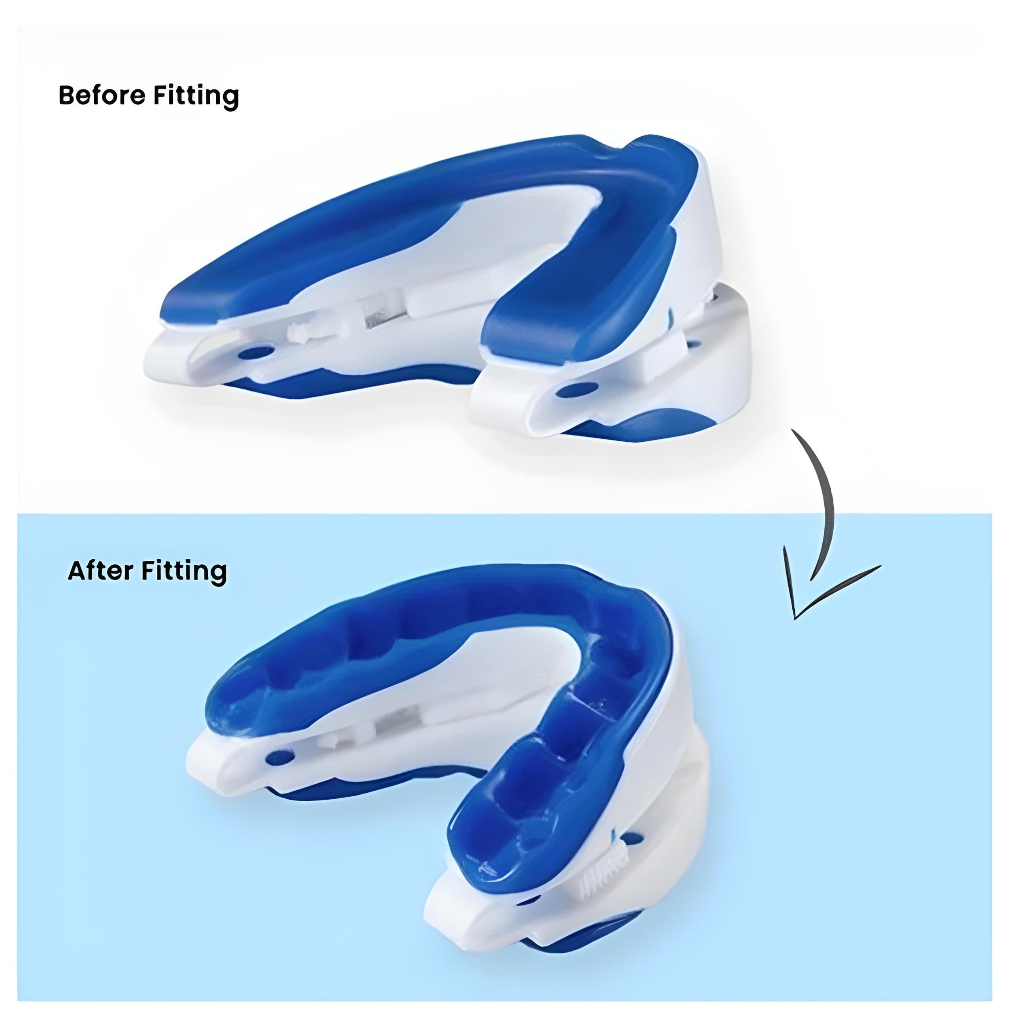 SilentBite – Anti-Snoring & Bruxism Guard