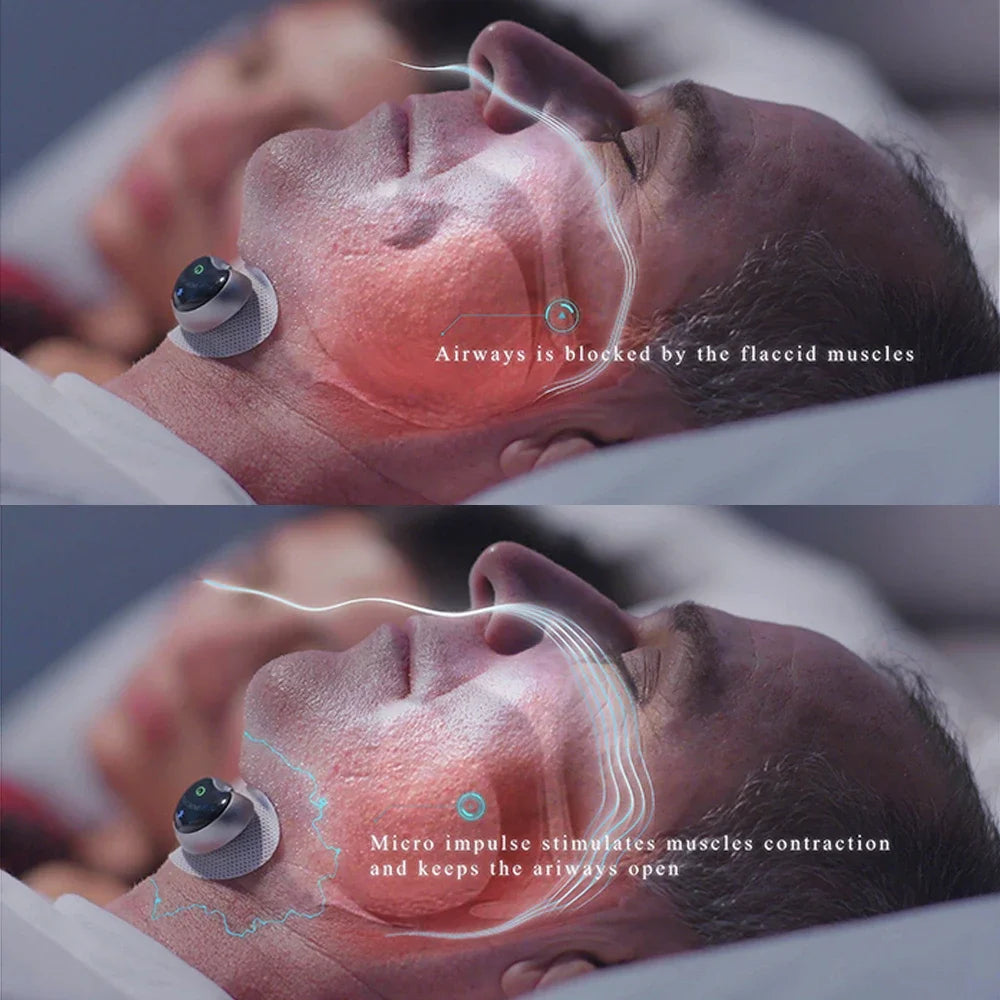 SilentWave – Anti-Snoring Solution